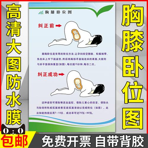 胸膝卧位图墙贴纸纠正前纠正成功示意图海报挂画孕妇护理健康挂图