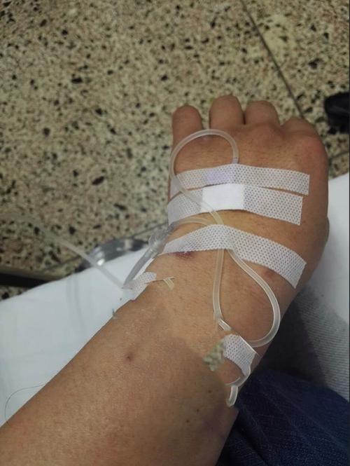 谁有男生输液的照片,只要手部照片,胖一点的,清晰一点