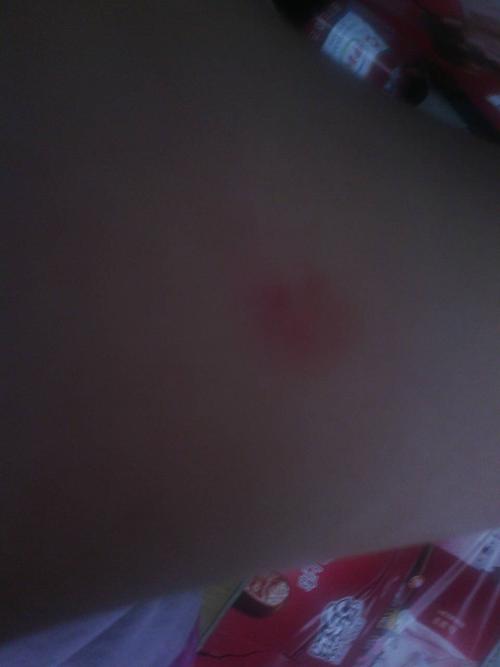 追问 不懂-_-# 追答 一般的话男生会把草莓留在女生的脖子上.