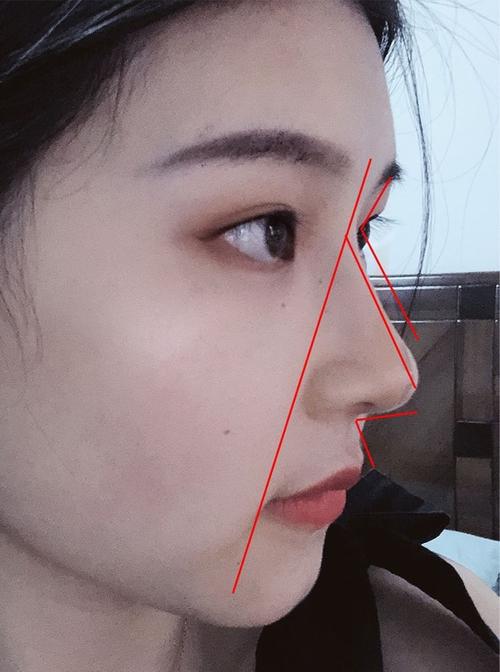 为什么鼻子侧面看着还挺高,正面就看不出来?