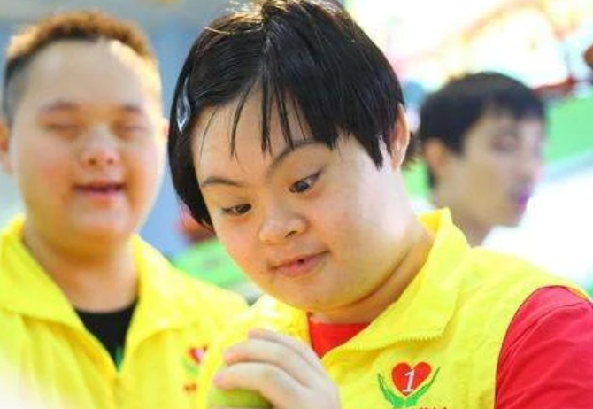 20分钟就会生出一个唐氏儿这3类孕妇的概率最高请自检