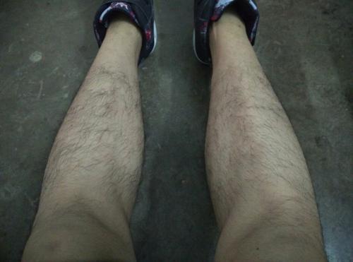 为什么有的男性腿毛旺盛有的却很光滑这和健康有关系吗