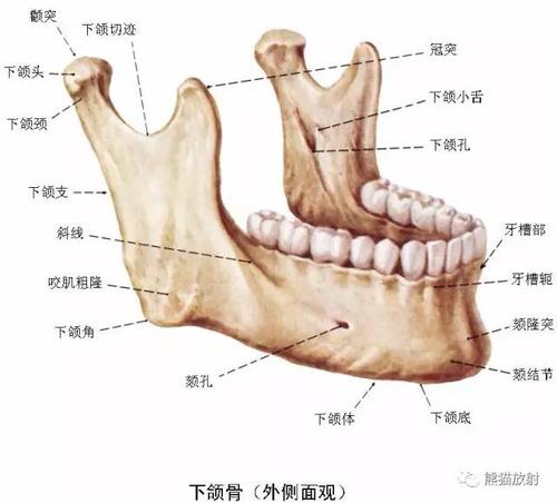 面部粉碎性骨折,下颌骨骨折ct表现