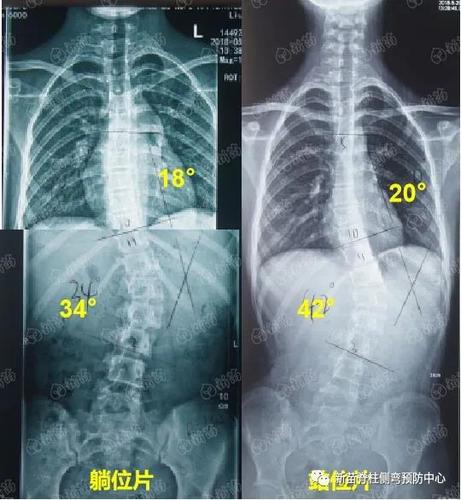 如何正确拍摄x光片