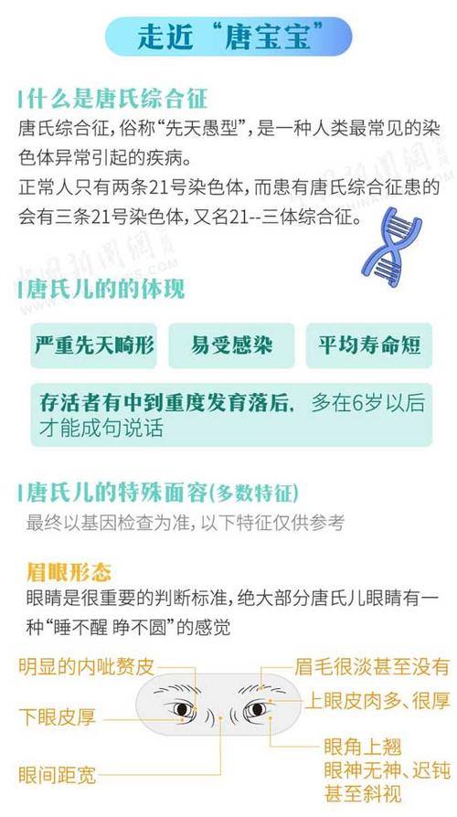 世界唐氏综合征日 一图科普唐氏儿