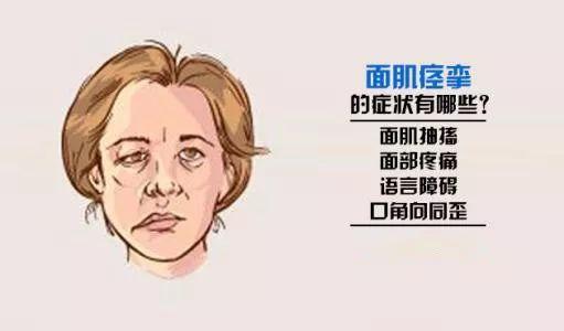 起病多从眼轮匝肌开始,然后涉及整个面部.面肌痉挛