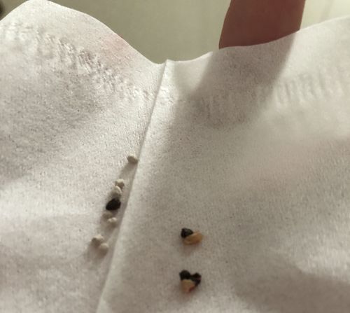 仓鼠的粪便这样 有问题吗?