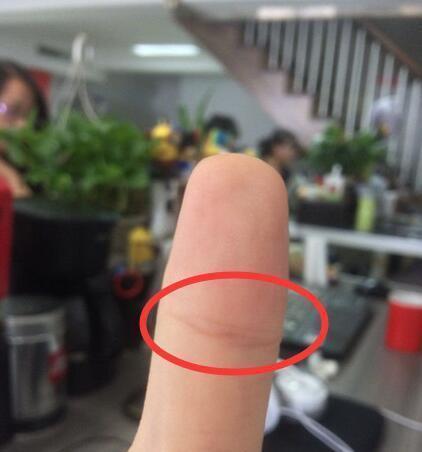 如图所示这就是佛眼纹,佛眼纹的位置已经圈出来了