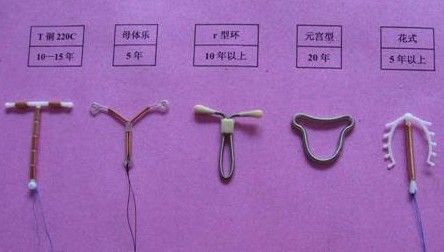 女性节育环未取怀孕又何风险?