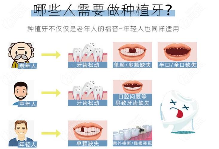 来分享保定种植牙价格表啦种牙技术好的医生给大家捋一捋