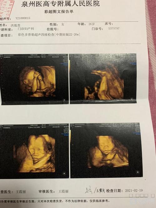 四维顺利通过,好奇男宝还是女宝,有会看的