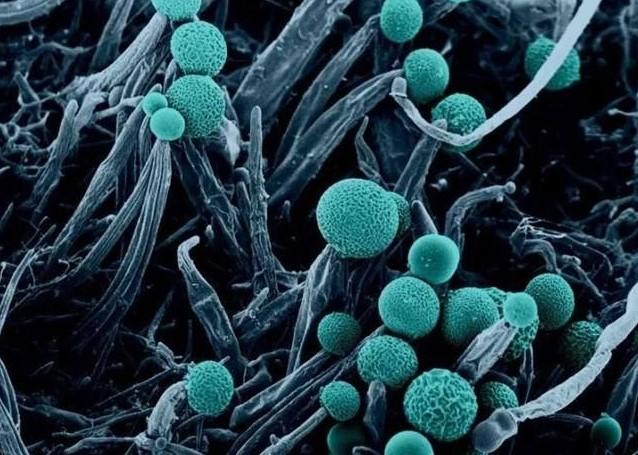 显微镜下霉菌的照片