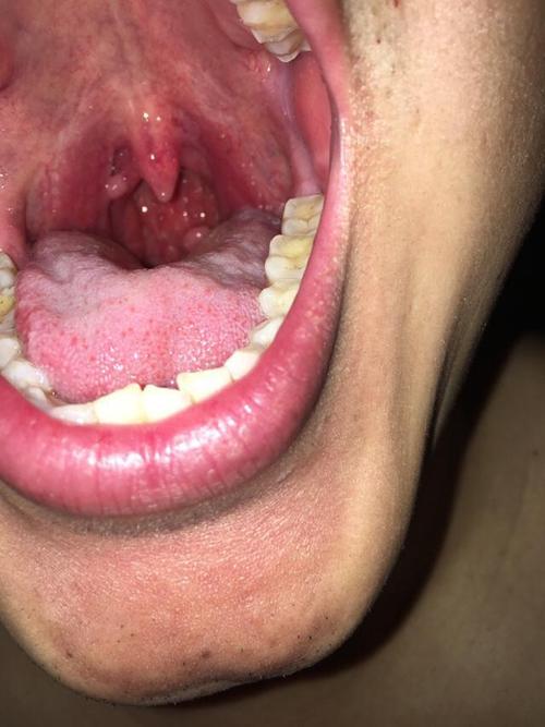 长个疙瘩也有这麼多的学问,皮肤长疙瘩本来就不是一件