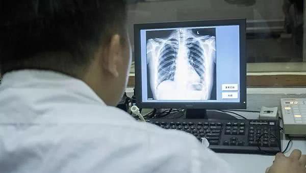 女人做"胸透"检查时,若清楚医生看到的内容,可能就不再害羞了