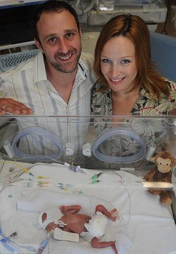 英最小双胞胎出生仅23周大 奇迹存活