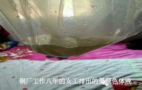 酸毒不排,小心得癌,1元排酸毒,把命"碱"回来!