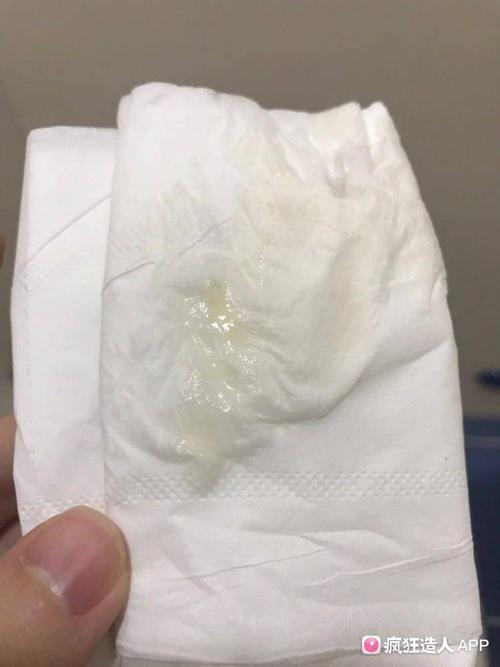 69 想要宝宝(疯狂造人) 24金豆 今天下午才有这现象,昨天是水样白带