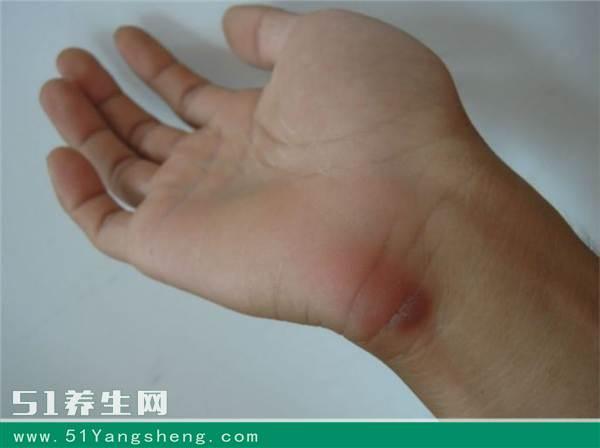 白领男预防鼠标手的妙招