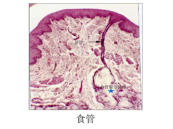 所有分类 高等教育 医学 组织胚胎学切片考试准备答案ppt  导管 食管