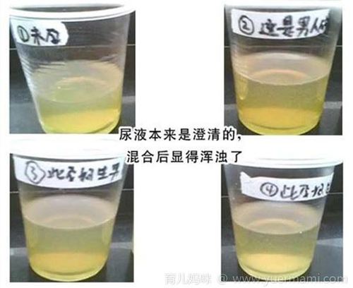 尿里放酒精怎样看男女 尿液 酒精测胎儿性别的方法