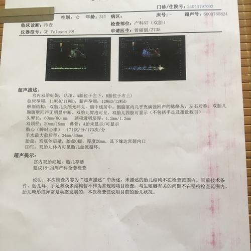 这是双绒双羊还是单绒双羊