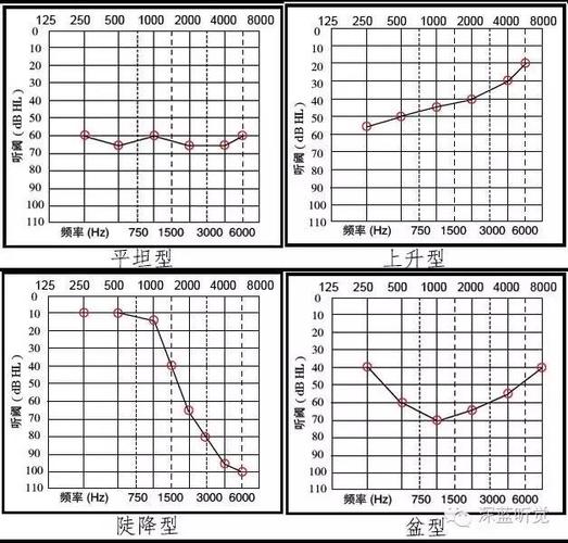 混合性听力损失   我们还可以根据听力曲线分为平坦型,渐降型,上升