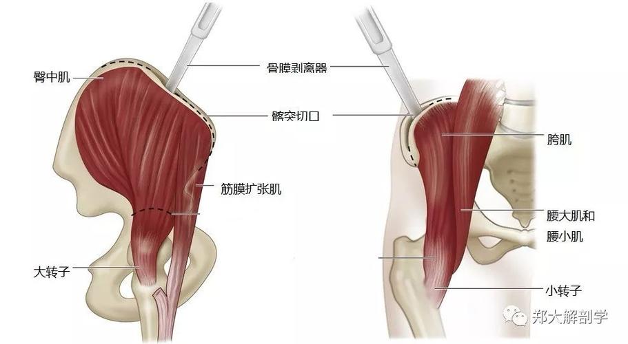 髋部外展肌 :筋膜扩张肌,臀中肌和臀小肌