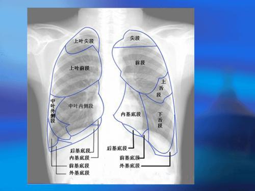 肺叶,肺段ct图解