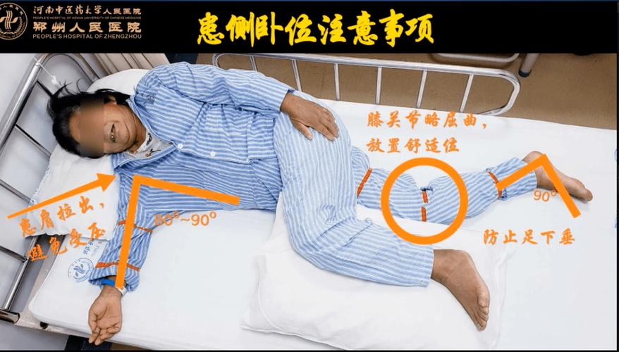 (三)患侧卧位健侧肢体自然放置.