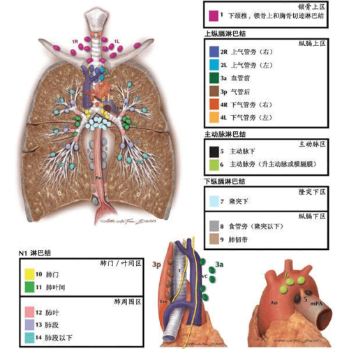 纵隔淋巴结分区图谱(美国胸科协会) 发表者:陈海石 (访问人次