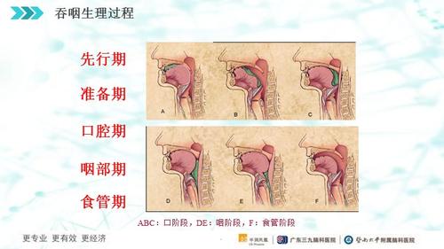 吞咽评估与解析