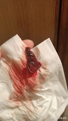 坎坷的药流经历分享给大家