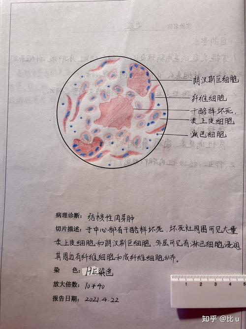 病理学实验绘图红蓝铅笔