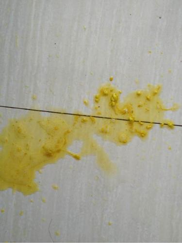 宝宝拉水样大便 而且里面有一粒一粒的东西