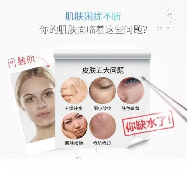 怎么判断皮肤真的缺水?肌肤缺水6大表现!