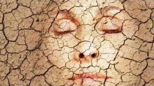 改善面部皮肤太粗糙方法冬季皮肤干燥起皮原因