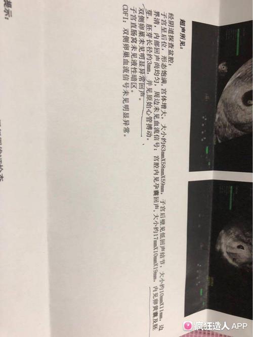 姐妹们有经验会看,帮我看看这个孕囊大小属于长型还是