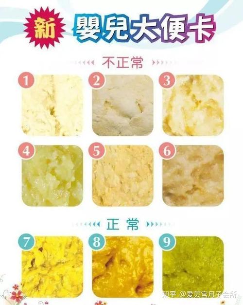 小宝宝的大便一般无定量,判断是否正常的关键是查看它的颜色和性状.