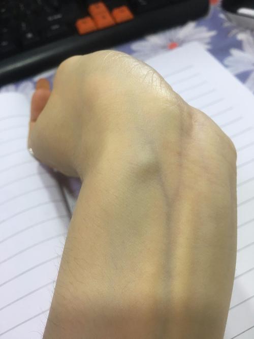 几个月前突然发现手腕压过去之后会鼓出一个小包