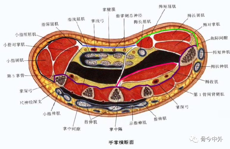 指蹼间隙:在掌骨头处,掌腱膜深层的横行纤维与其向远端发出的4束纵行