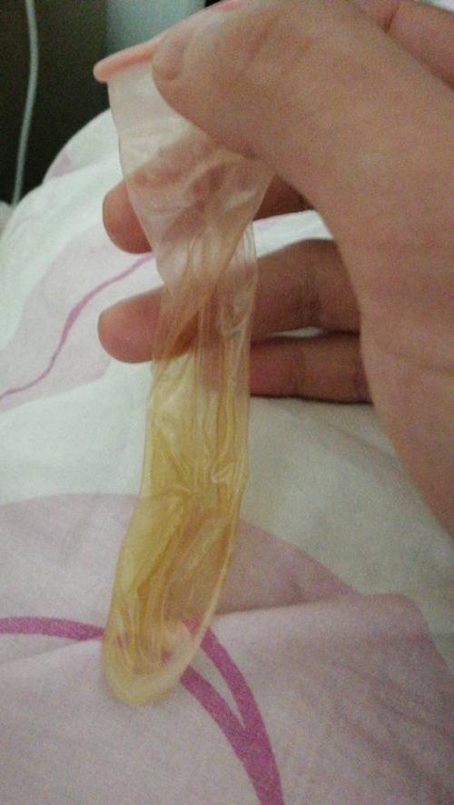 这是男朋友用过的避孕套正常?