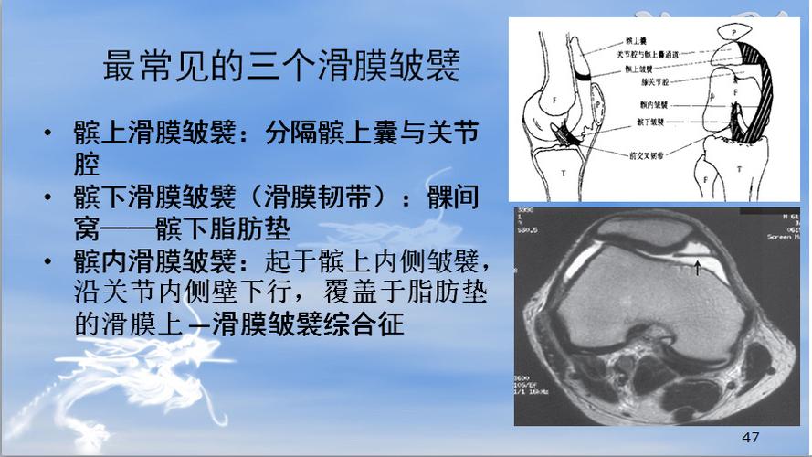 膝关节断层解剖