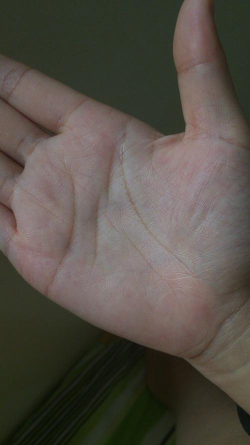 智慧线不知道是二条还是断开是不是很不好啊