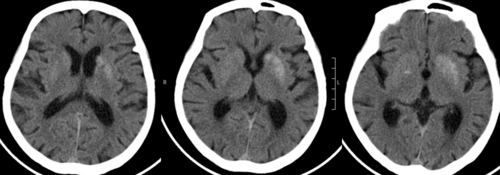 头部 ct (来源:作者提供)