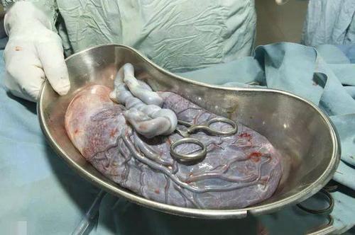 "吃了胎盘后,身体变好了":胎盘真的能强身健体,美容养颜?