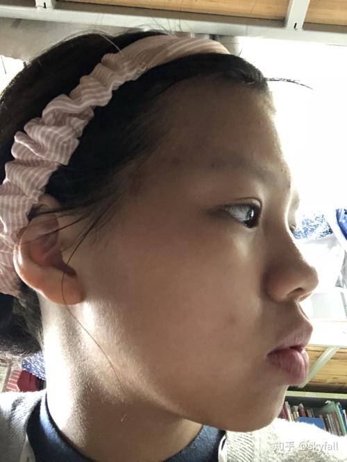 正脸好看但侧脸丑到爆是种怎样的体验