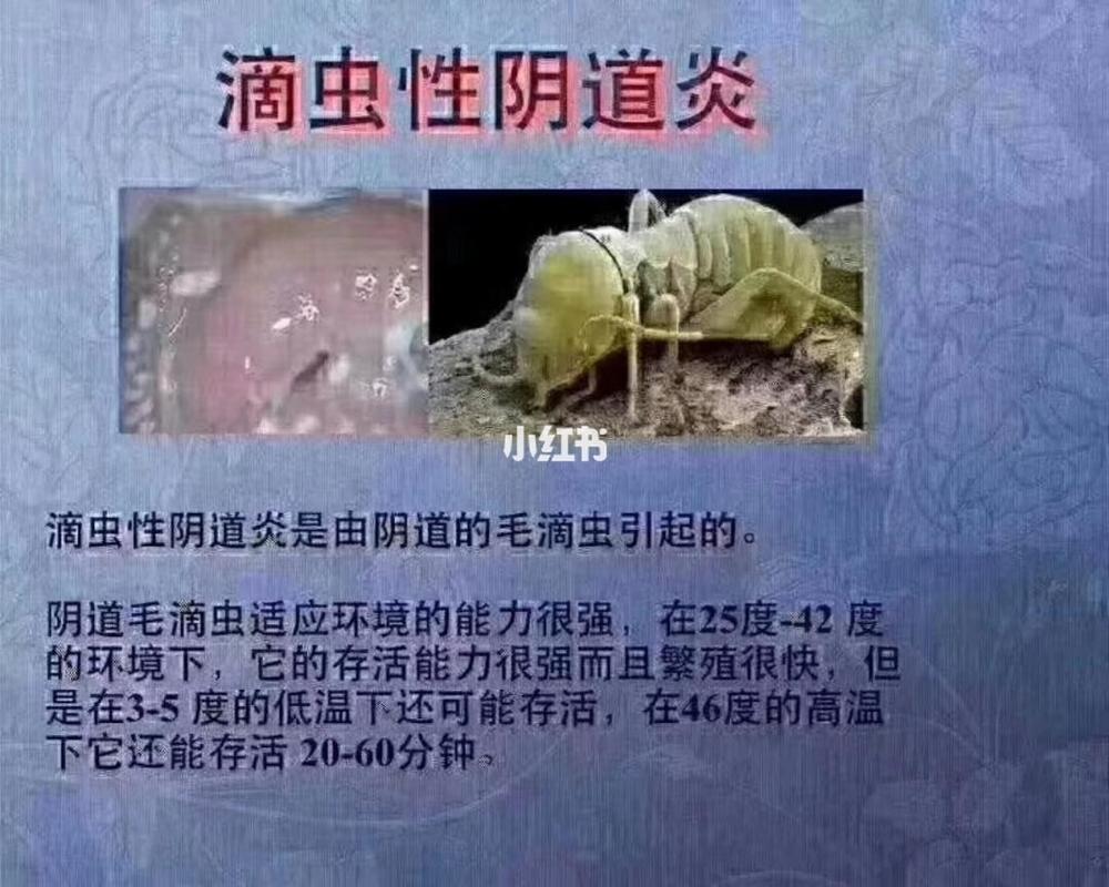 妇科小知识 有过滴虫92美女们都知道,是特别痒的,而且滴虫厉害了