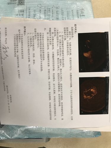 激素六项都正常,月经推迟的,老公精子正常,就想看一下这样的怎样治疗