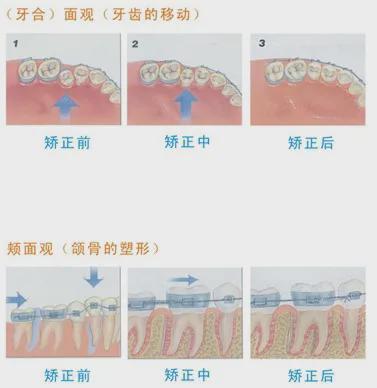 网友花式补牙欣赏有些钱还是让牙医赚吧