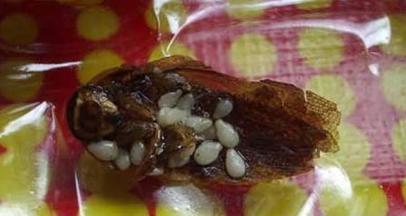 士力架吃出烂牙 盘点那些年我们吃出的恶心异物(组图)(11)